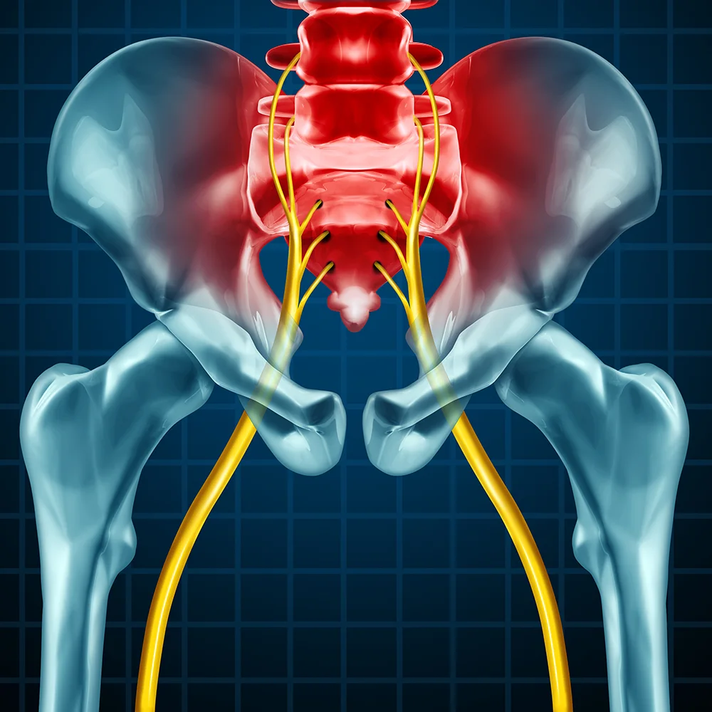 What Can Help Ease Sciatica?